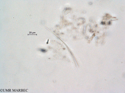 phyto/Scattered_Islands/all/COMMA April 2011/Geitlerinema sp(copy)_thumb.jpg